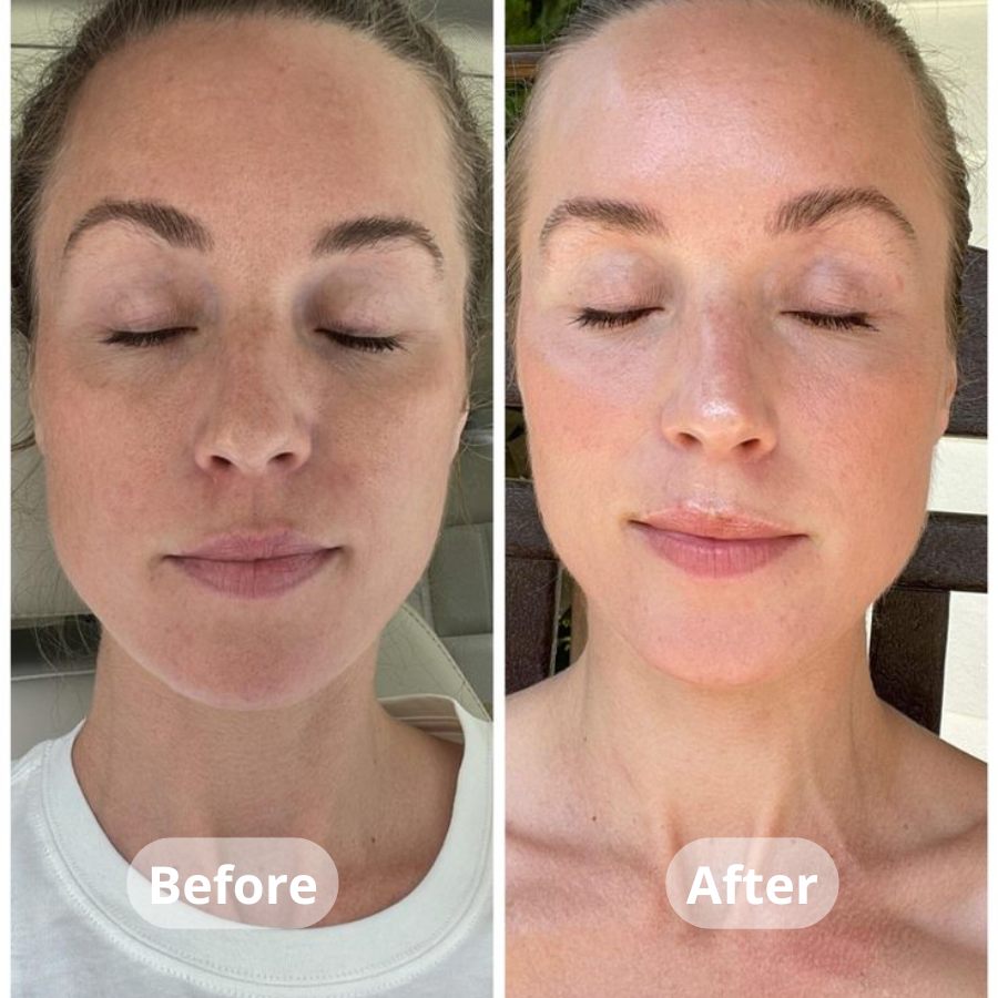 Medicube Kojic Acid Turmeric Overnight Wrapping Peel Off Mask