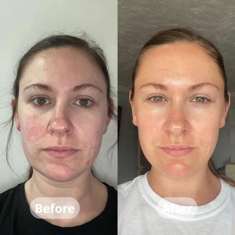 Medicube Kojic Acid Turmeric Overnight Wrapping Peel Off Mask