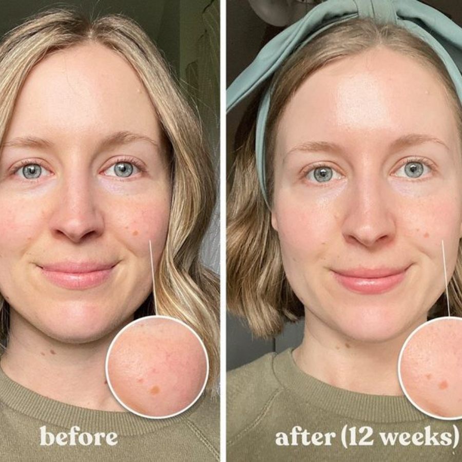Medicube Kojic Acid Turmeric Overnight Wrapping Peel Off Mask