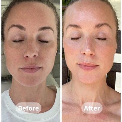 Medicube Kojic Acid Turmeric Overnight Wrapping Peel Off Mask