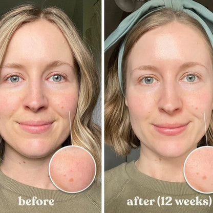 Medicube Kojic Acid Turmeric Overnight Wrapping Peel Off Mask